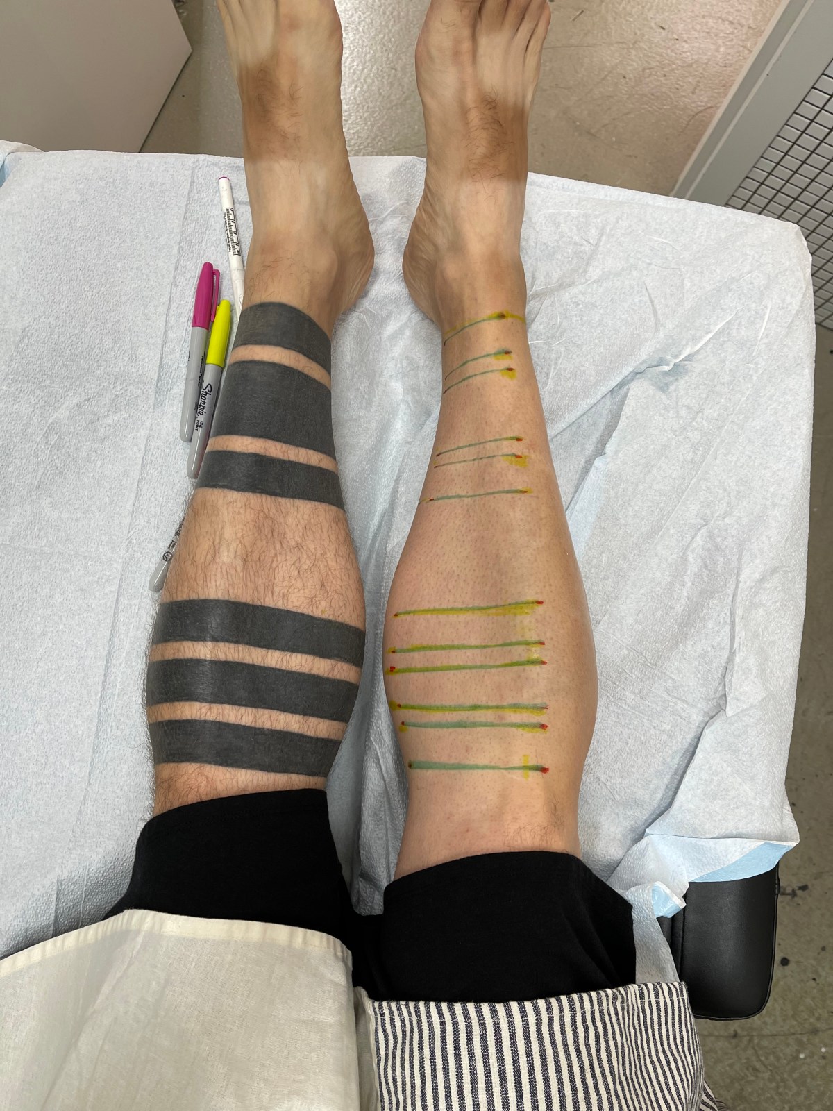 Wetting the bed……