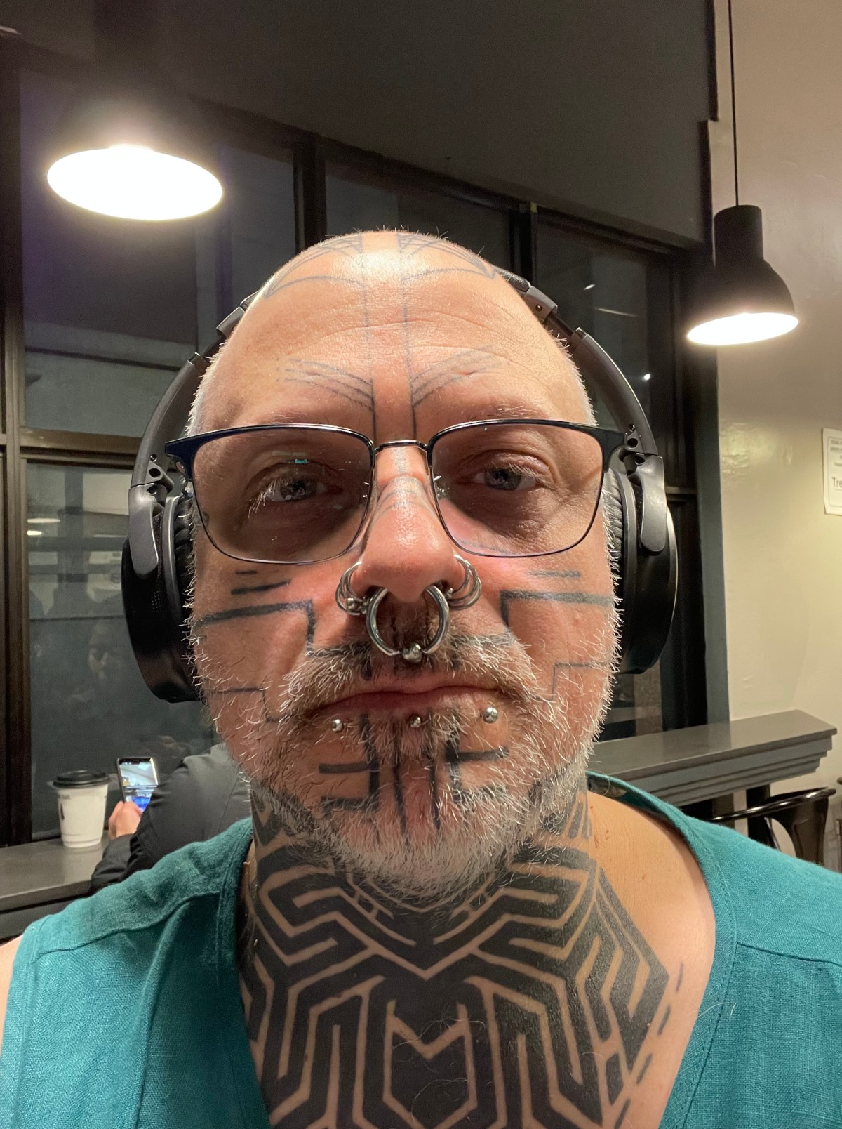 Escitalopram, acne, and white&nbsp;hair.